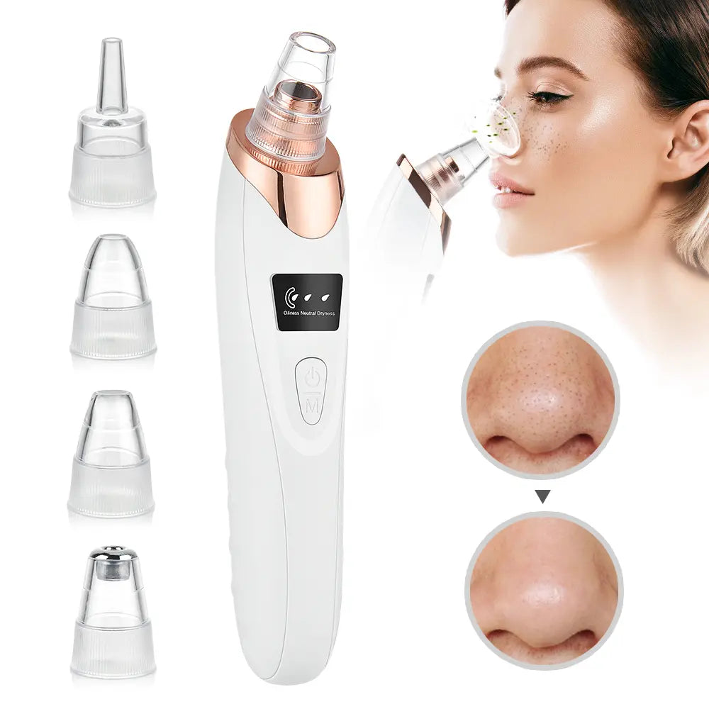 2026 Newest Facial Blackhead Remover Pore Vacuum - USB Rechargeable with Rechargeable Battery, 4 Replacement Tips, Heat Compression - Extractor Tool Set Skin Care Devices for Effective Blackhead Removal,Back to School,Back to School Haul